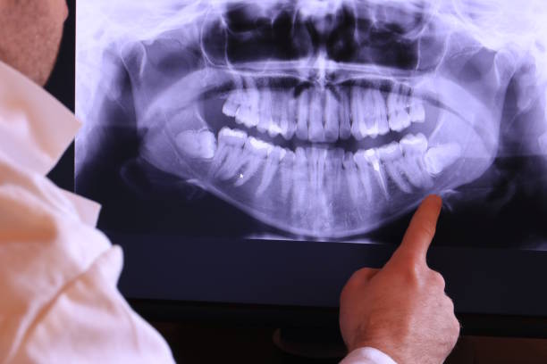 Best Emergency Root Canal Treatment in Marine City, MI