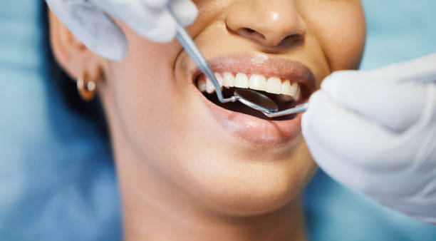 Best Emergency Dental Extractions in Marine City, MI