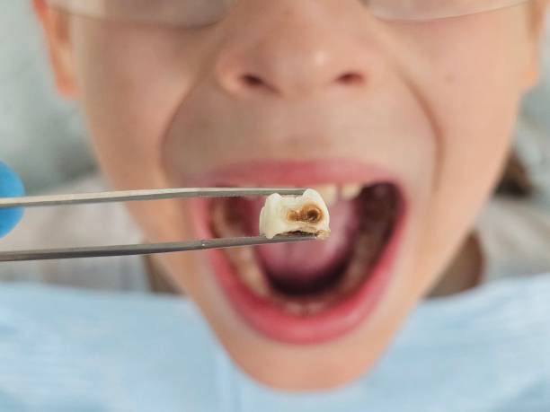 Best Mobile Emergency Dentist in Marine City, MI